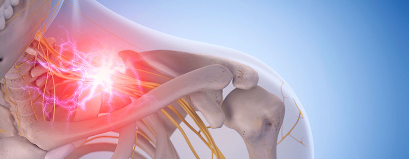 patient needing pinched nerve in need of Spinal Decompression Therapy in Raleigh