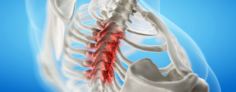 patient needing Spinal Stenosis in need of Spinal Decompression Therapy in Raleigh